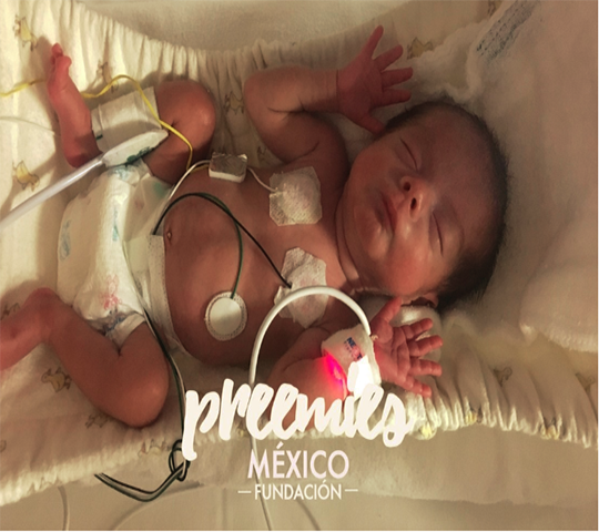 Foto: IG @preemiesmexico